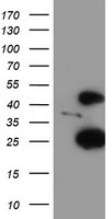 CENPH / CENP-H Antibody - HEK293T cells were transfected with the pCMV6-ENTRY control (Left lane) or pCMV6-ENTRY CENPH (Right lane) cDNA for 48 hrs and lysed. Equivalent amounts of cell lysates (5 ug per lane) were separated by SDS-PAGE and immunoblotted with anti-CENPH.