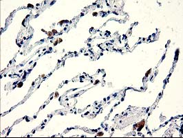 CENPH / CENP-H Antibody - IHC of paraffin-embedded Human lung tissue using anti-CENPH mouse monoclonal antibody.