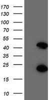 CENPH / CENP-H Antibody - HEK293T cells were transfected with the pCMV6-ENTRY control (Left lane) or pCMV6-ENTRY CENPH (Right lane) cDNA for 48 hrs and lysed. Equivalent amounts of cell lysates (5 ug per lane) were separated by SDS-PAGE and immunoblotted with anti-CENPH.