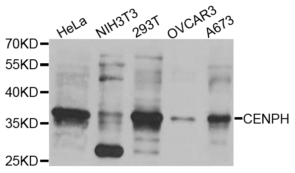 CENPH / CENP-H Antibody - Western blot analysis of extracts of various cell lines.