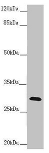 CENPH / CENP-H Antibody - Western blot All Lanes:CENPH antibody at 1.61 ug/ml+ Mouse lung tissue Secondary Goat polyclonal to rabbit IgG at 1/10000 dilution Predicted band size: 28 kDa Observed band size: 28 kDa