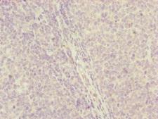 CENPH / CENP-H Antibody - Immunohistochemistry of paraffin-embedded human tonsil tissue at dilution of 1:100
