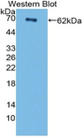 CENPI / CENP-I Antibody - Western blot of CENPI / CENP-I antibody.