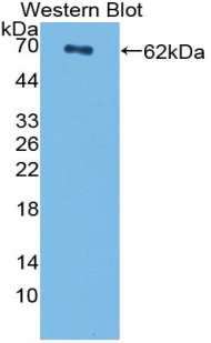 CENPI / CENP-I Antibody - Western blot of CENPI / CENP-I antibody.