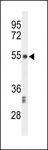 CENPI / CENP-I Antibody - Western blot of CENPI Antibody in CEM cell line lysates (35 ug/lane). CENPI (arrow) was detected using the purified antibody.