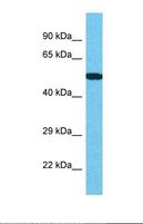 CENPI / CENP-I Antibody - Western blot of Human Thyroid Tumor. CENPI antibody dilution 1.0 ug/ml.  This image was taken for the unconjugated form of this product. Other forms have not been tested.