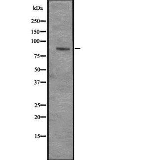 CENPI / CENP-I Antibody - Western blot analysis of CENPI expression in HeLa cells lysate. The lane on the left is treated with the antigen-specific peptide.