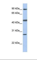 CENPI / CENP-I Antibody - MCF7 cell lysate. Antibody concentration: 1.0 ug/ml. Gel concentration: 12%.  This image was taken for the unconjugated form of this product. Other forms have not been tested.