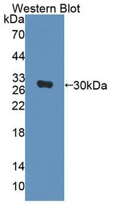 CENPJ / LAP Antibody - Western blot of CENPJ / LAP antibody.
