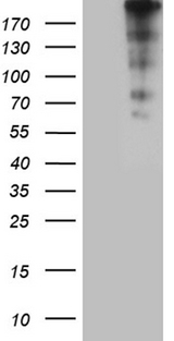 CENPJ / LAP Antibody - HEK293T cells were transfected with the pCMV6-ENTRY control. (Left lane) or pCMV6-ENTRY CENPJ. (Right lane) cDNA for 48 hrs and lysed