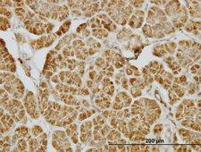 CENPJ / LAP Antibody - Immunoperoxidase of monoclonal antibody to CENPJ on formalin-fixed paraffin-embedded human pancreas. [antibody concentration 1.5 ug/ml]