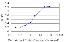 CENPJ / LAP Antibody - Detection limit for recombinant GST tagged CENPJ is approximately 0.03 ng/ml as a capture antibody.