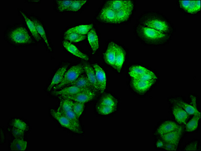 CENPJ / LAP Antibody - Immunofluorescence staining of HepG2 cells at a dilution of 1:200, counter-stained with DAPI. The cells were fixed in 4% formaldehyde, permeabilized using 0.2% Triton X-100 and blocked in 10% normal Goat Serum. The cells were then incubated with the antibody overnight at 4 °C.The secondary antibody was Alexa Fluor 488-congugated AffiniPure Goat Anti-Rabbit IgG (H+L) .
