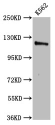 CENPJ / LAP Antibody - Positive Western Blot detected in K562 whole cell lysate. All lanes: CENPJ antibody at 3.2 µg/ml Secondary Goat polyclonal to rabbit IgG at 1/50000 dilution. Predicted band size: 154, 125 KDa. Observed band size: 125 KDa