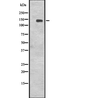 CENPJ / LAP Antibody - Western blot analysis of CENPJ expression in Jurkat cells lysate. The lane on the left is treated with the antigen-specific peptide.