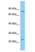 CENPK Antibody - CENPK antibody Western Blot of 293T. Antibody dilution: 1 ug/ml.  This image was taken for the unconjugated form of this product. Other forms have not been tested.