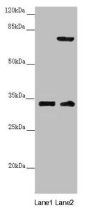 CENPK Antibody - Western blot All Lanes:CENPK antibody at 3.98 ug/ml Lane 1: PC-3 whole cell lysate Lane 2: 293T whole cell lysate Secondary Goat polyclonal to rabbit IgG at 1/10000 dilution Predicted band size: 32 kDa Observed band size: 32,75 kDa