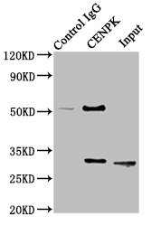 CENPK Antibody - Immunoprecipitating CENPK in Hela whole cell lysate Lane 1: Rabbit control IgG instead of CENPK Antibody in Hela whole cell lysate.For western blotting, a HRP-conjugated Protein G antibody was used as the secondary antibody (1/2000) Lane 2: CENPK Antibody (8µg) + Hela whole cell lysate (500µg) Lane 3: Hela whole cell lysate (10µg)