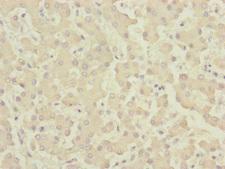 CENPK Antibody - Immunohistochemistry of paraffin-embedded human liver tissue at dilution of 1:100