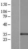 CENPK Protein - Western validation with an anti-DDK antibody * L: Control HEK293 lysate R: Over-expression lysate