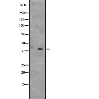 CENPL Antibody - Western blot analysis of CENPL expression in HT1080 whole cells lysate. The lane on the left is treated with the antigen-specific peptide.