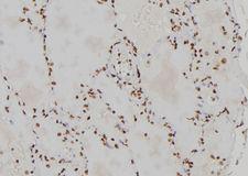 CENPL Antibody - 1:100 staining human lung tissue by IHC-P. The sample was formaldehyde fixed and a heat mediated antigen retrieval step in citrate buffer was performed. The sample was then blocked and incubated with the antibody for 1.5 hours at 22°C. An HRP conjugated goat anti-rabbit antibody was used as the secondary.