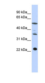 CENPM Antibody - CENPM antibody Western blot of HepG2 cell lysate. This image was taken for the unconjugated form of this product. Other forms have not been tested.
