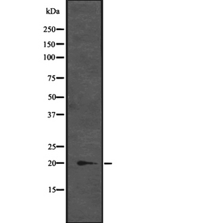CENPM Antibody - Western blot analysis of CENPM expression in K562 cell lysates at 25ug/lane. The lane on the left is treated with the antigen-specific peptide.