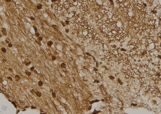 CENPM Antibody - 1:100 staining mouse brain tissue by IHC-P. The sample was formaldehyde fixed and a heat mediated antigen retrieval step in citrate buffer was performed. The sample was then blocked and incubated with the antibody for 1.5 hours at 22°C. An HRP conjugated goat anti-rabbit antibody was used as the secondary.