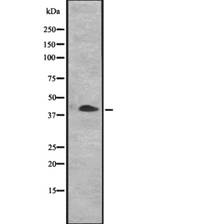 CENPN / CENP-N Antibody - Western blot analysis of CENPN expression in MCF-7 cells lysate. The lane on the left is treated with the antigen-specific peptide.