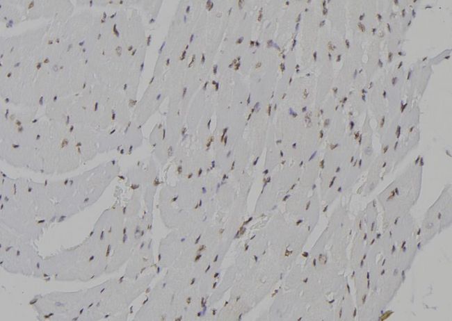 CENPN / CENP-N Antibody - 1:100 staining mouse heart tissue by IHC-P. The sample was formaldehyde fixed and a heat mediated antigen retrieval step in citrate buffer was performed. The sample was then blocked and incubated with the antibody for 1.5 hours at 22°C. An HRP conjugated goat anti-rabbit antibody was used as the secondary.