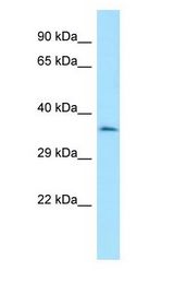 CENPO Antibody - CENPO antibody Western Blot of HepG2.  This image was taken for the unconjugated form of this product. Other forms have not been tested.