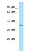 CENPO Antibody - CENPO antibody Western Blot of HepG2.  This image was taken for the unconjugated form of this product. Other forms have not been tested.