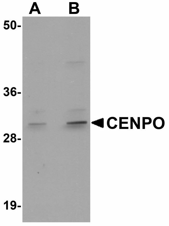 CENPO Antibody - Western blot of CENPO in mouse kidney tissue lysate with CENPO antibody at (A) 1 and (B) 2 ug/ml.