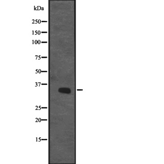 CENPO Antibody - Western blot analysis of CENPO expression in HL-60 cells line lysate. The lane on the left is treated with the antigen-specific peptide.