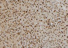 CENPO Antibody - 1:100 staining mouse liver tissue by IHC-P. The sample was formaldehyde fixed and a heat mediated antigen retrieval step in citrate buffer was performed. The sample was then blocked and incubated with the antibody for 1.5 hours at 22°C. An HRP conjugated goat anti-rabbit antibody was used as the secondary.