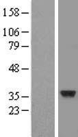 CENPO Protein - Western validation with an anti-DDK antibody * L: Control HEK293 lysate R: Over-expression lysate