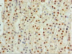 CENPQ Antibody - Immunohistochemistry of paraffin-embedded human adrenal gland using antibody at 1:100 dilution.