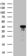 CENPQ Antibody - HEK293T cells were transfected with the pCMV6-ENTRY control. (Left lane) or pCMV6-ENTRY CENPQ. (Right lane) cDNA for 48 hrs and lysed. Equivalent amounts of cell lysates. (5 ug per lane) were separated by SDS-PAGE and immunoblotted with anti-CENPQ. (1:2000)
