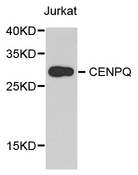 CENPQ Antibody - Western blot analysis of extract of various cells.