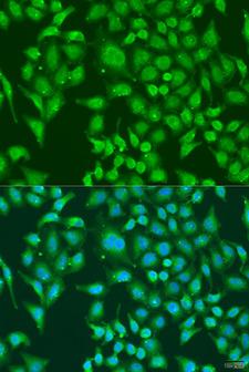 CENPQ Antibody - Immunofluorescence analysis of U2OS cells using CENPQ Polyclonal Antibody at dilution of 1:100.Blue: DAPI for nuclear staining.