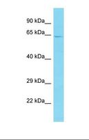 CENPT Antibody - Western blot of Human HepG2. CENPT antibody dilution 1.0 ug/ml.  This image was taken for the unconjugated form of this product. Other forms have not been tested.