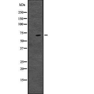 CENPT Antibody - Western blot analysis of CENPT expression in HepG2 cells lysate. The lane on the left is treated with the antigen-specific peptide.