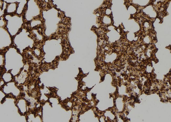 CENPT Antibody - 1:100 staining mouse lung tissue by IHC-P. The sample was formaldehyde fixed and a heat mediated antigen retrieval step in citrate buffer was performed. The sample was then blocked and incubated with the antibody for 1.5 hours at 22°C. An HRP conjugated goat anti-rabbit antibody was used as the secondary.