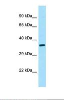 CENPU / MLF1IP Antibody - Western blot of Human 721_B . MLF1IP antibody dilution 1.0 ug/ml.  This image was taken for the unconjugated form of this product. Other forms have not been tested.