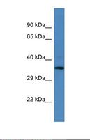 CENPU / MLF1IP Antibody - Western blot of Human Placenta . MLF1IP antibody dilution 1.0 ug/ml.  This image was taken for the unconjugated form of this product. Other forms have not been tested.