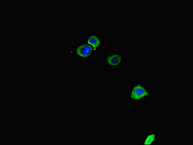 CENPU / MLF1IP Antibody - Immunofluorescent analysis of HepG2 cells diluted at 1:100 and Alexa Fluor 488-congugated AffiniPure Goat Anti-Rabbit IgG(H+L)