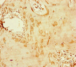 CENPU / MLF1IP Antibody - Immunohistochemistry of paraffin-embedded human placenta tissue at dilution of 1:100
