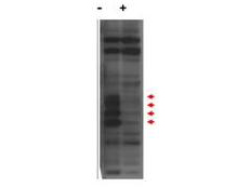 CENPU / MLF1IP Antibody - Western blot using the affinity purified anti-MLF1IP / PBIP1 antibody shows detection of endogenous MLF1IP protein (a tier of four modified protein bands indicated by the arrowheads) in lysates of Hela cells (- lane). Cells treated with MLF1IP / PBIP1 shRNA (+ lane) show no staining. The identities of the higher and lower molecular weight bands are unknown. Primary antibody was used at 1:1,000.