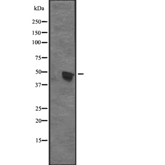 CENPU / MLF1IP Antibody - Western blot analysis of CENPU expression in A431 whole cells lysate. The lane on the left is treated with the antigen-specific peptide.